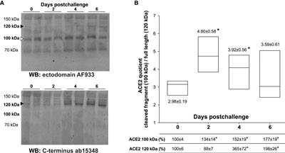 Serum angiotensin-converting enzyme 2 as a potential biomarker for SARS-CoV-2 infection and vaccine efficacy